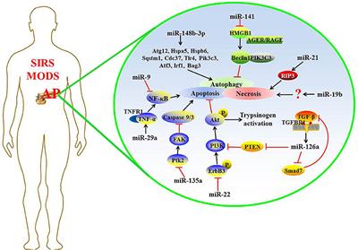 Targeting MicroRNA Function in Acute Pancreatitis